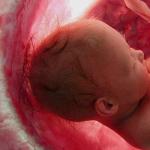 Девятый месяц беременности: подготовка к родам и просроченная беременность Тянет живот на 9 месяце